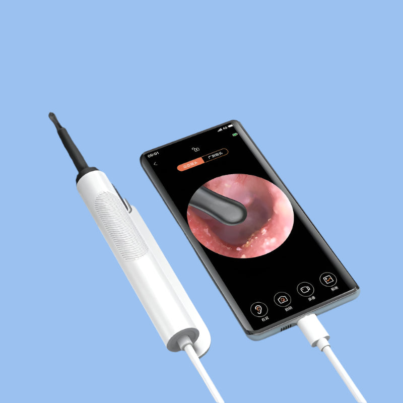 Ear Wax Cleaner with Camera 3.5Mm Earwax Clean Otoscope 500W Pixel Earwax Remover with Ear Spoon Support Android Type-C Phone